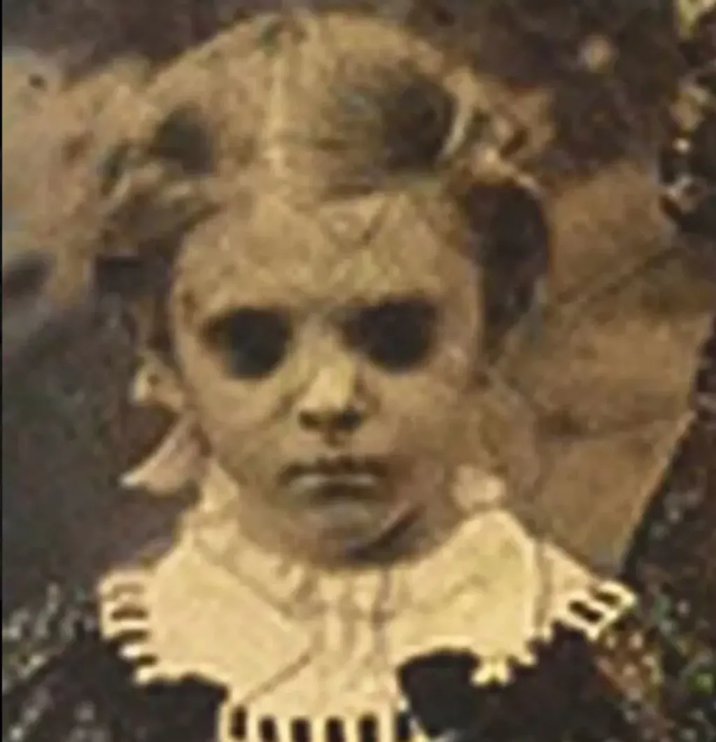 Aseguran que se trata de una niña muerte en el siglo XIX producto de una terrible enfermedad que le hundió los ojos. Foto: Gentileza The Sun.