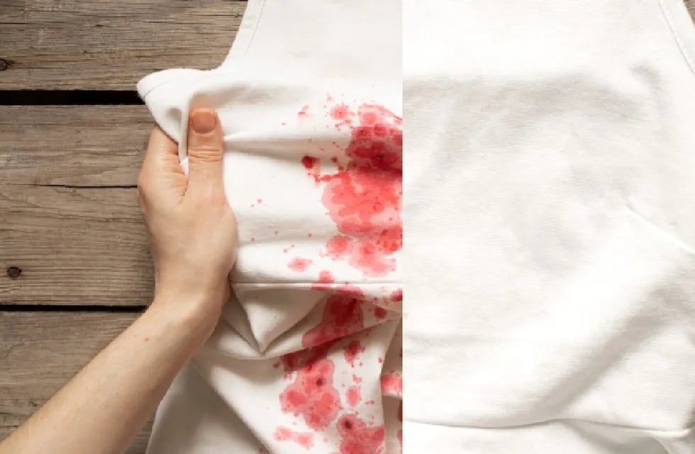 Manchas de sangre en prendas de ropa.
