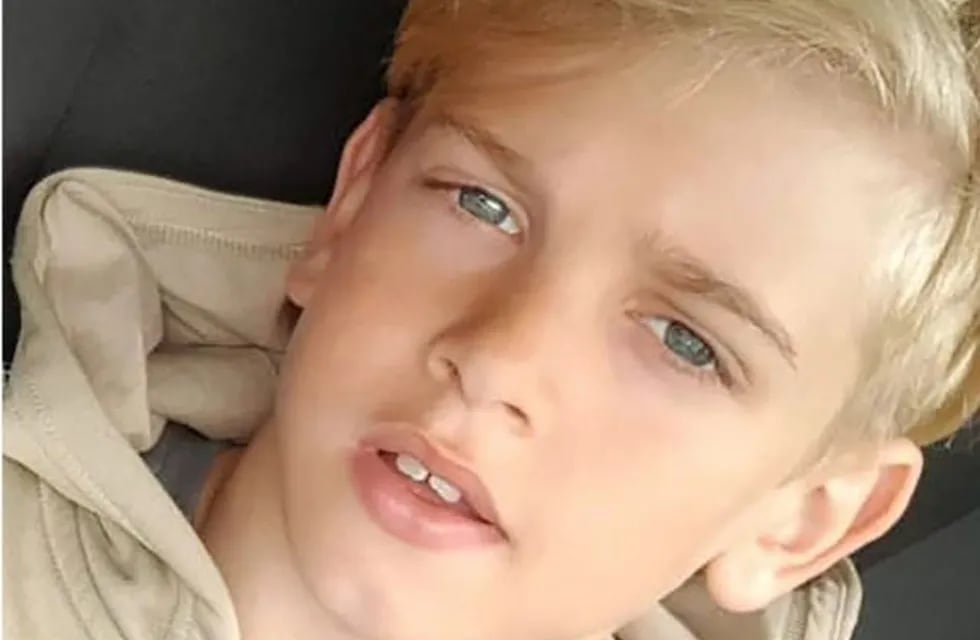 Murió Archie Battersbee, el niño británico que sufrió muerte cerebral por un reto viral.
