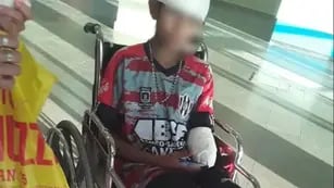 Un niño perdió un brazo al ser atacado por pitbulls