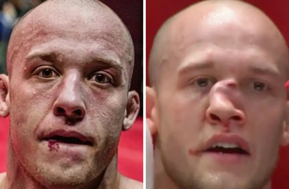 El luchador Blake Perry quedó con su rostro desfigurado por un rodillazo en la cara.