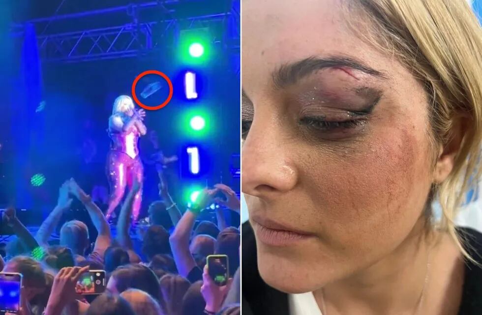 Agredieron en un show en vivo a la artista Bebe Rexha arrojándole un celular en la cara en Nueva York.