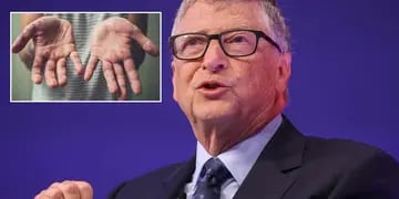 El pronóstico que Bill Gates había realizado sobre la viruela del mono