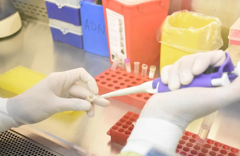 En 15 minutos el nuevo test detecta antígenos, proteínas que se expresan en las células ante la presencia del coronavirus. / Mariana Villa