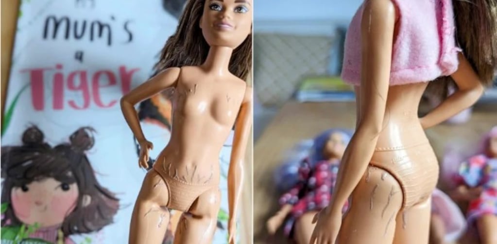 La Barbie con estrías, la muñeca que le regaló una madre a su hija. Gentileza: Clarín.