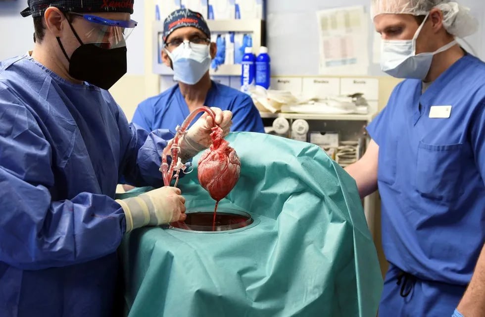 Un equipo de cirujanos de los Estados Unidos trasplantó con éxito el corazón de un cerdo modificado genéticamente a un humano.