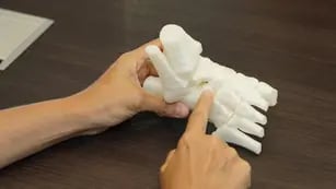 Junín prótesis impresoras 3D
