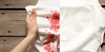 Manchas de sangre en prendas de ropa.