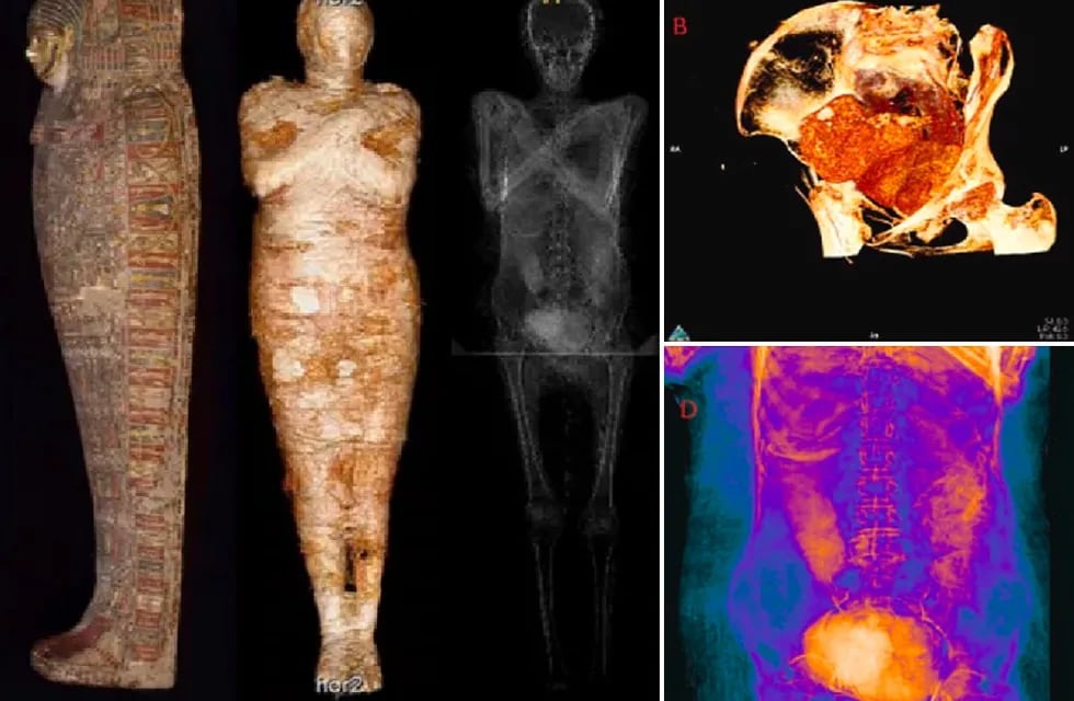 La momia de una mujer embarazada en Egipto - Academia de Ciencias de Polonia