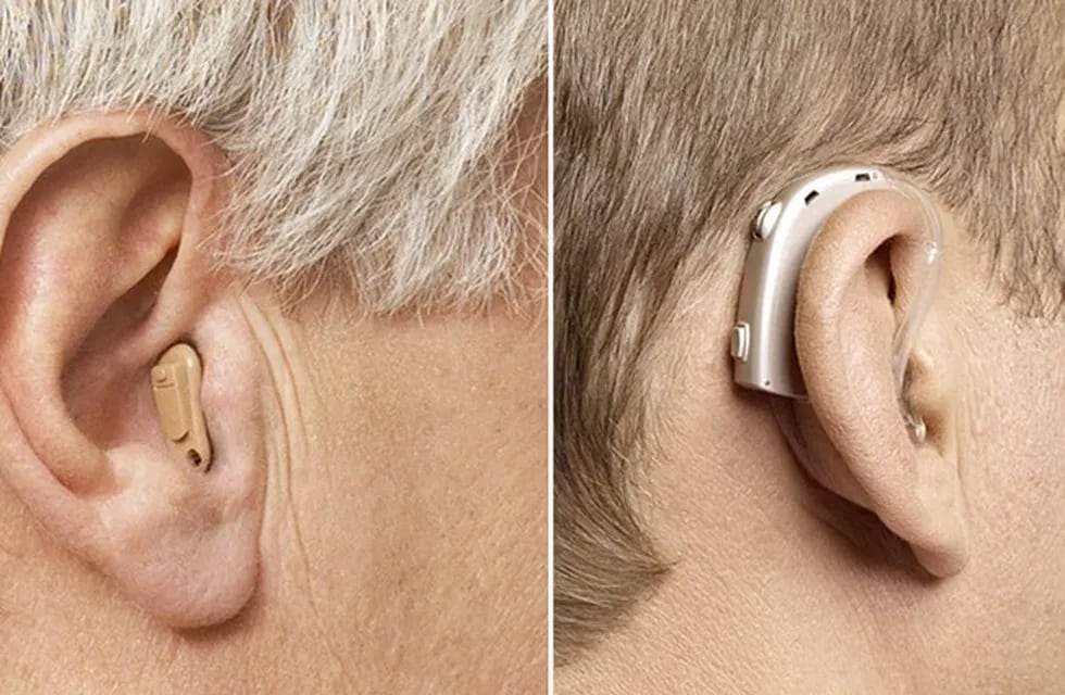 Actualmente, unos 1.500 millones de personas en el mundo experimentan un deterioro del sentido del oído. Imagen ilustrativa / Web