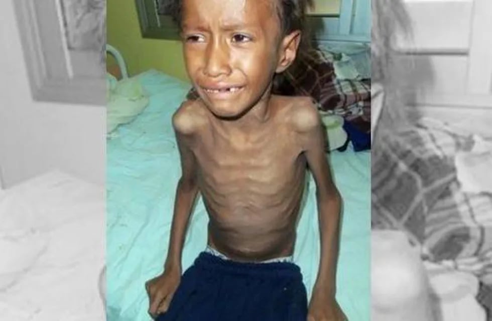 Murió Néstor Femenía, el nene qom desnutrido y enfermo de tuberculosis