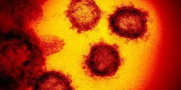 El nuevo coronavirus Sars-CoV-2, también conocido como 2019-nCoV, el virus causa Covid-19. (Niaid-RML vía AP/Archivo)