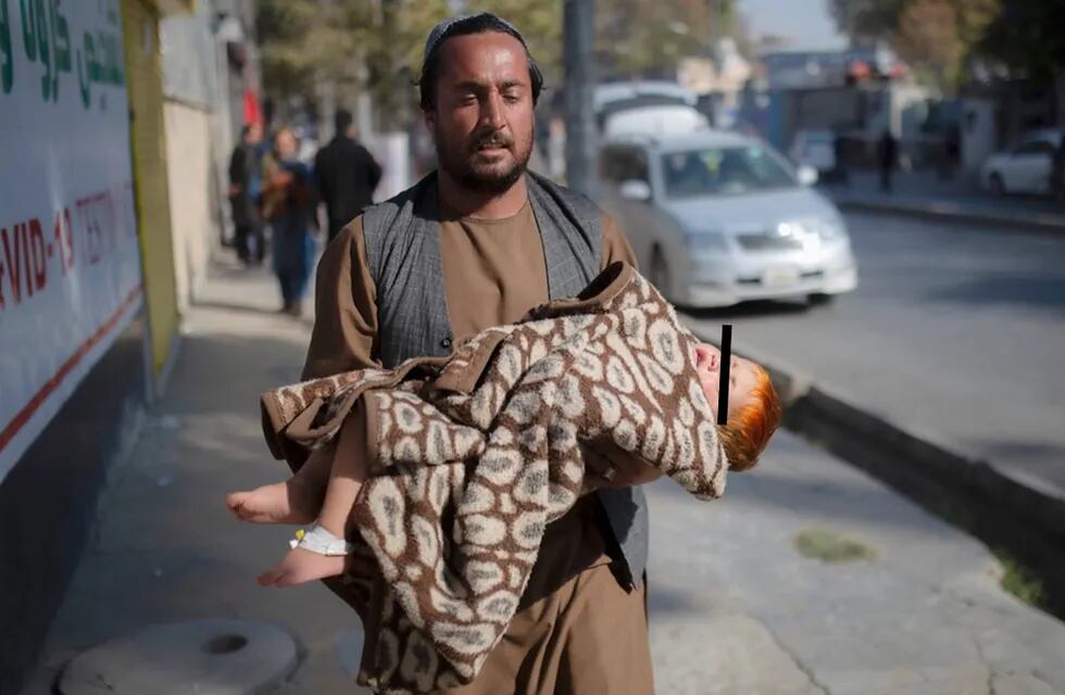 Atentado en hospital de Kabul deja más de 20 muertos