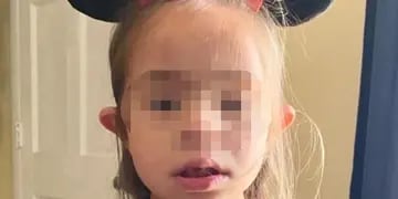 La niña de 7 años a la que le ataron un barbijo en la cabeza tiene síndrome de Down