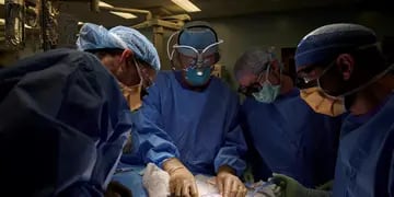 Trasplantaron un riñón de chancho a una persona