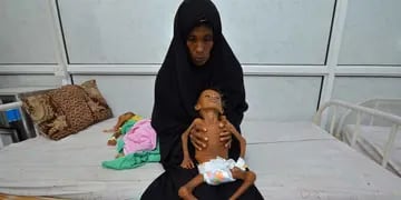 Yemen se muere de hambre