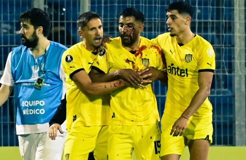 Maxi Olivera, el jugador de Peñarol que fue agredido en el campo de juego del Gigante de Arroyito. (Captura).