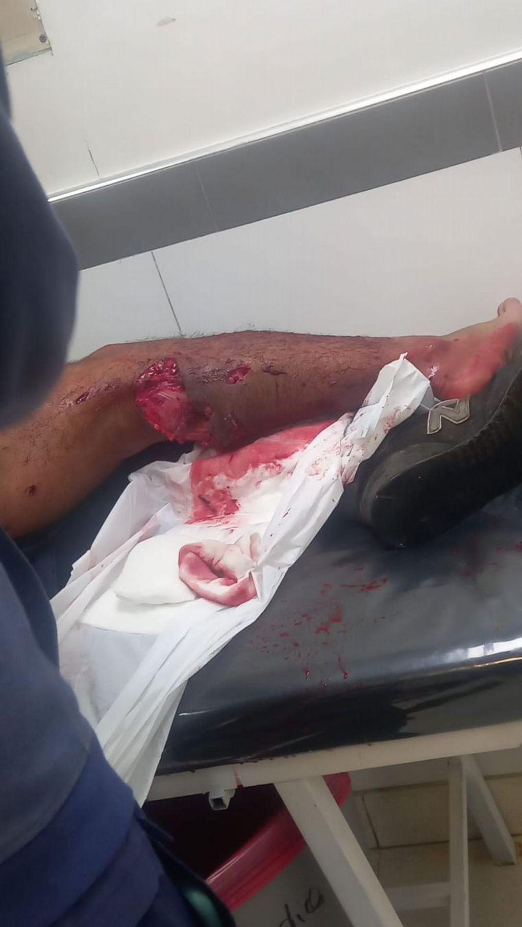 Impactante imagen: perros Dogo atacaron a un ladrón y le desgarraron una pierna. Foto: Policía de Córdoba