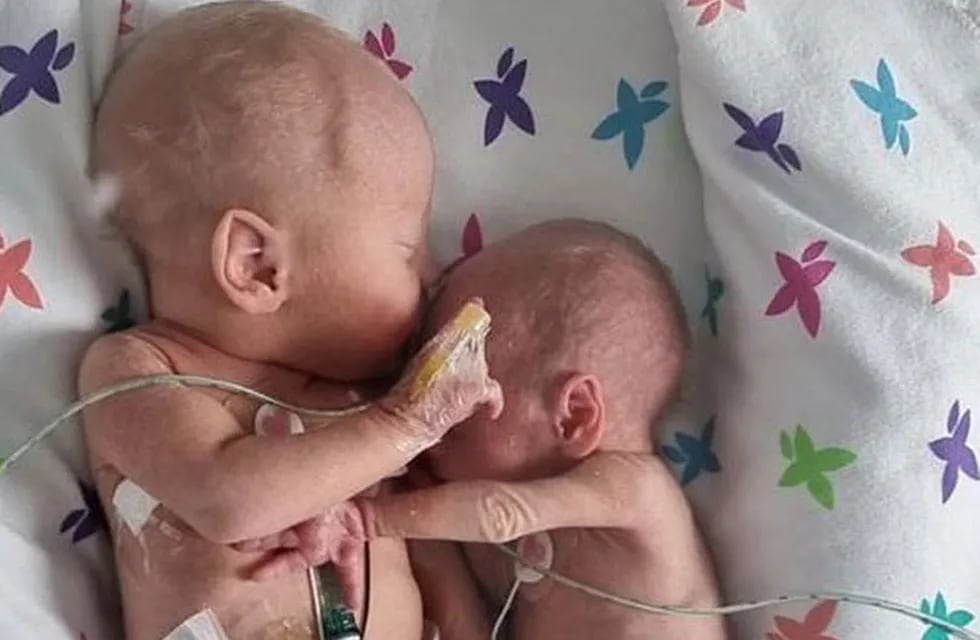 Dos bebés gemelos se abrazaron tras ser reunidos en la misma incubadora.