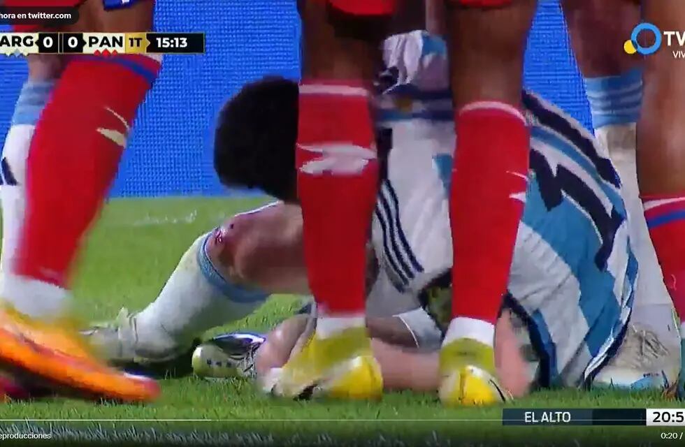 Amonestado Kevin Galván en Panama por una fuerte patada a Lionel Messi. / Gentileza.