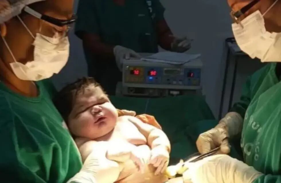 Nació un superbebé de más de 7 kilos en Brasil y estableció un nuevo récord.