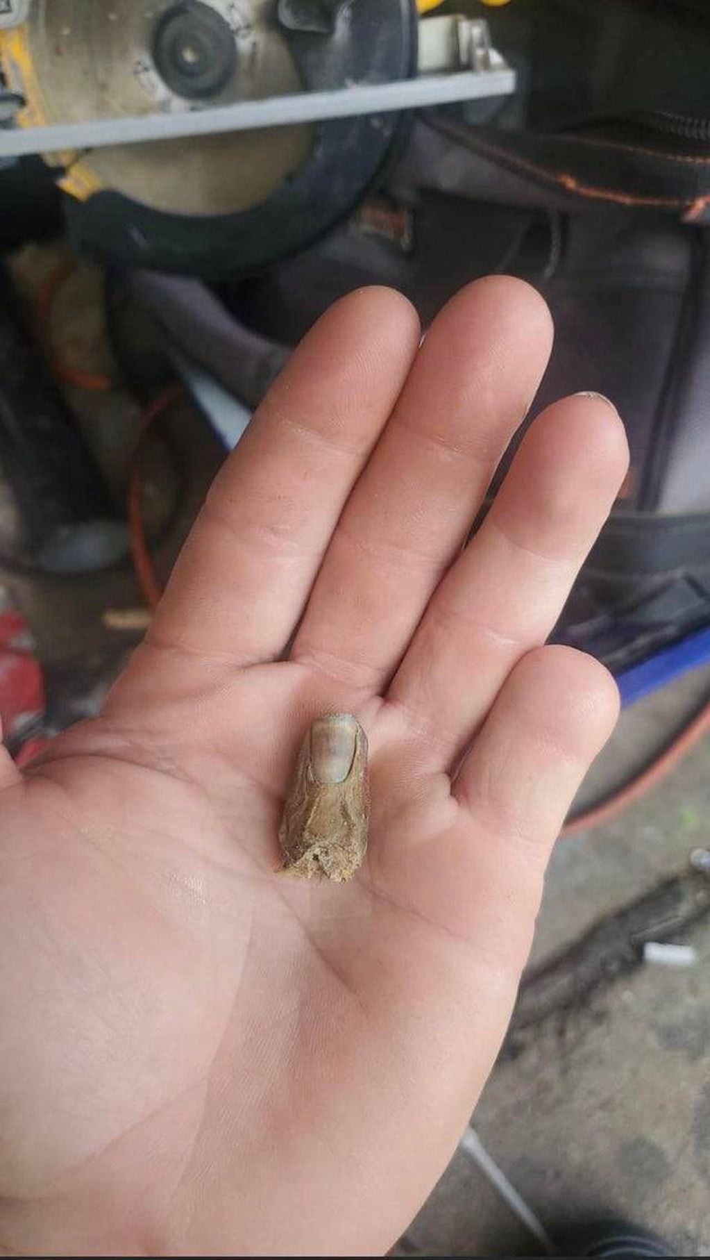 El joven compartió una foto en las redes sociales luego de encontrar su dedo meñique.