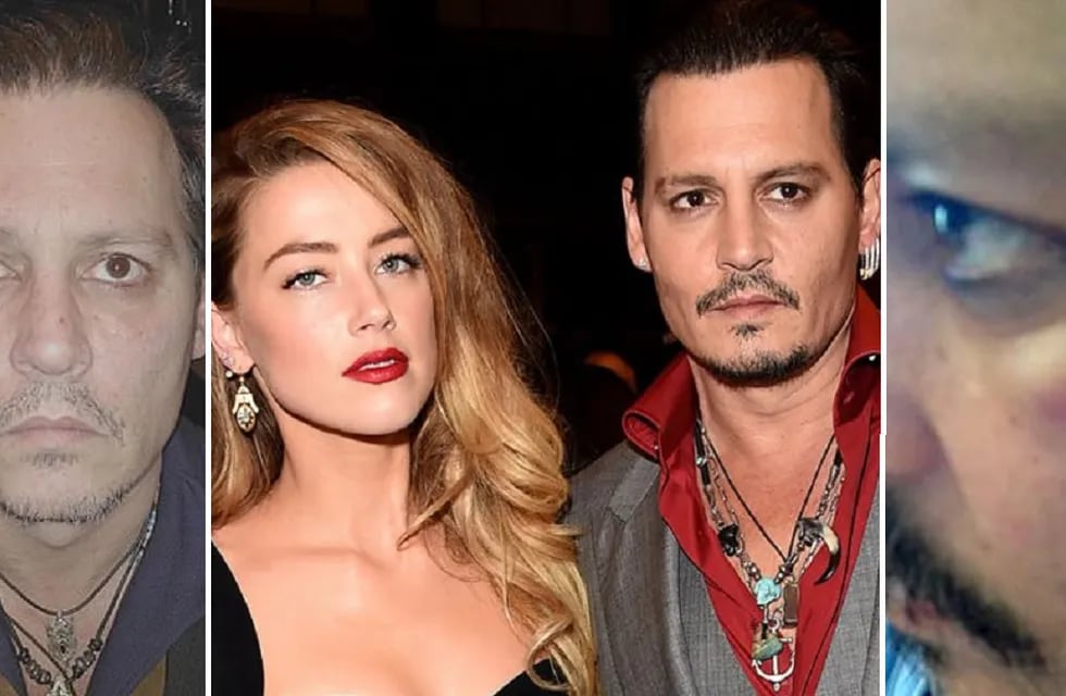 Las imágenes y audios que revelan que Amber Heard atacó a golpes a Johnny Depp