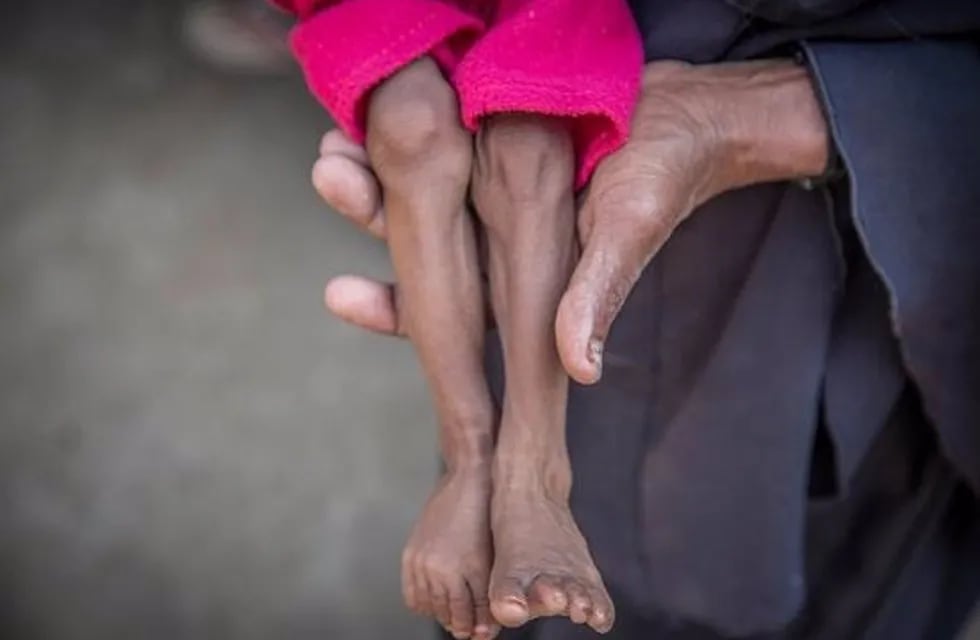 21/11/2018 Un niño con desnutrición.

La organización no gubernamental Save the Children ha denunciado este miércoles que cerca de 85.000 niños menores de cinco años podrían haber muerto por inanición desde abril de 2015 en Yemen como consecuencia de la guerra que está viviendo el país.

POLITICA ORIENTE PRÓXIMO ASIA INTERNACIONAL YEMEN
SAVE THE CHILDREN

