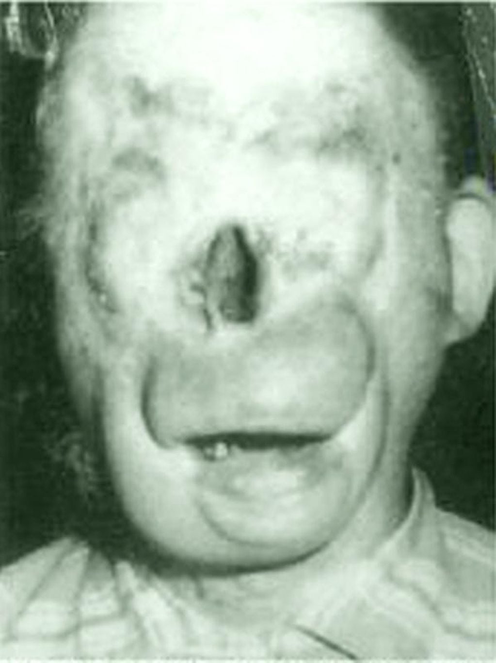 Un sujeto sufrió la desfiguración de su rostro y eso dio pie para el surgimiento de una tenebrosa leyenda.