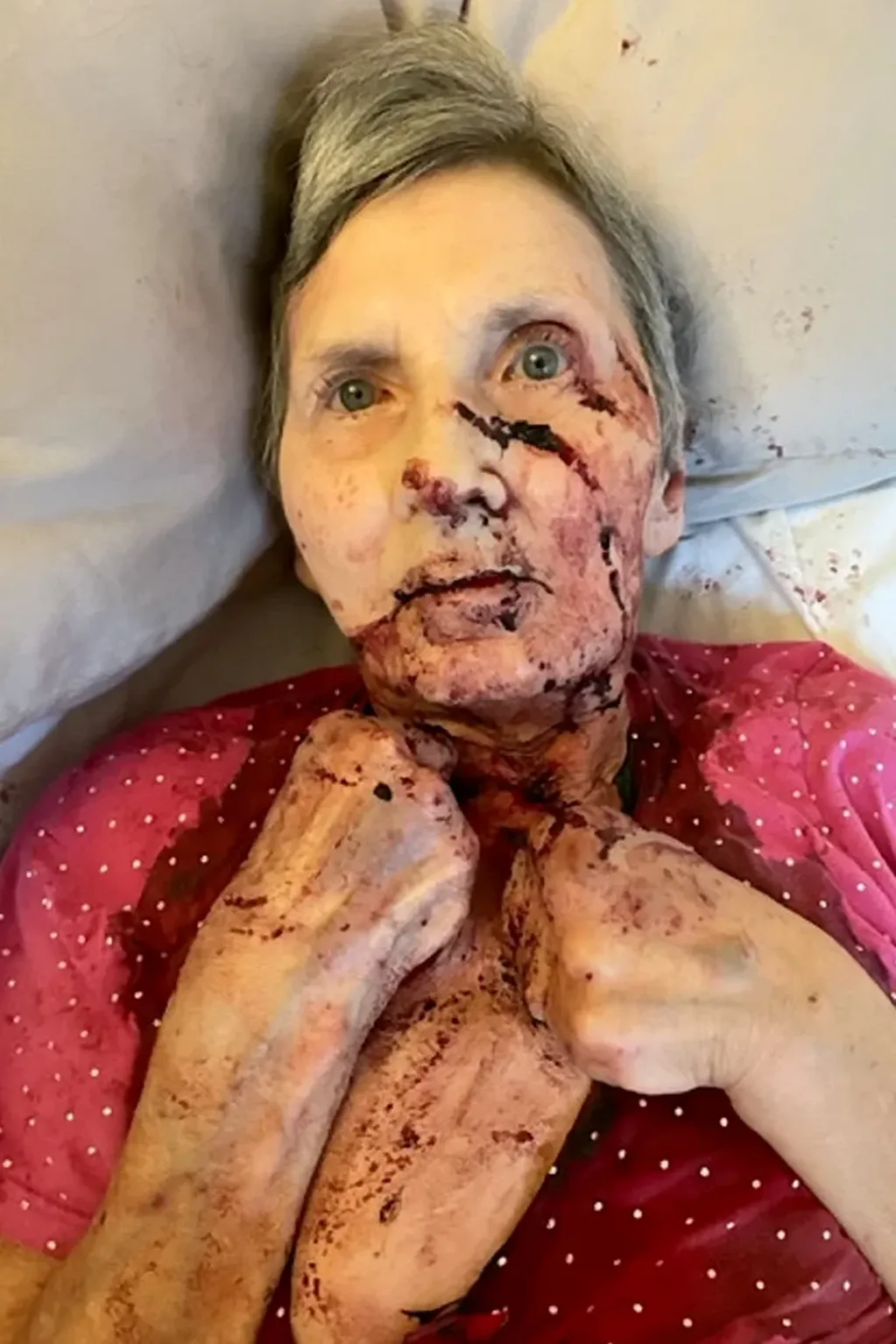 Una anciana postrada en una cama sufrió en brutal ataque de una enorme rata.