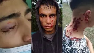 Violencia policial: entraron a una fiesta y le dispararon decenas de balas de goma a 11 adolescentes