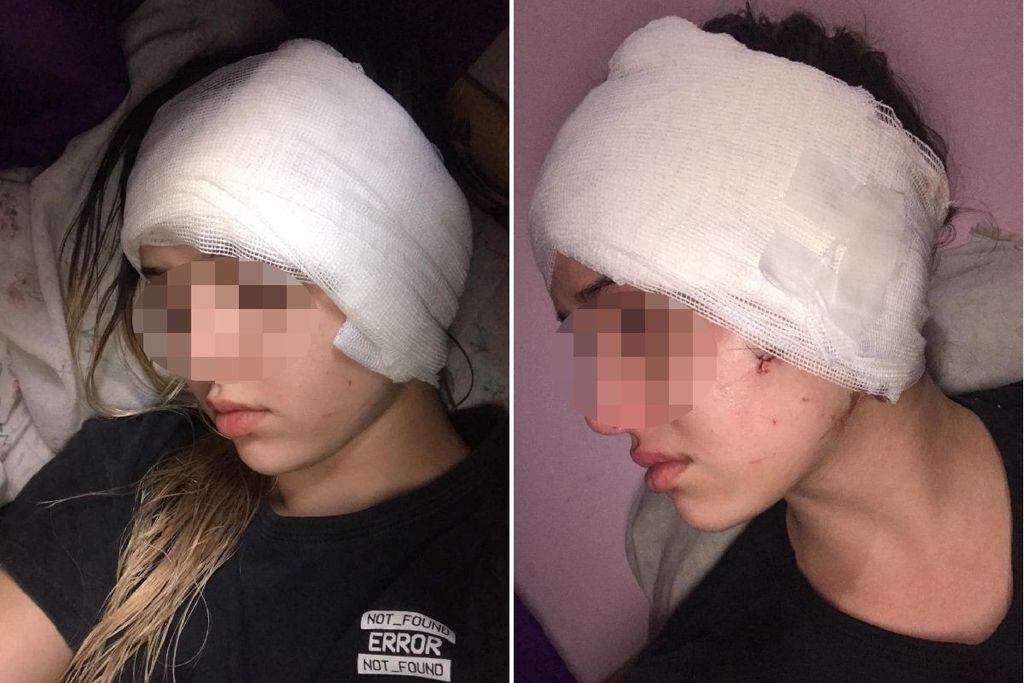 Así quedó la moza atacada en la calle Arístides de la Ciudad de Mendoza (Facebook)