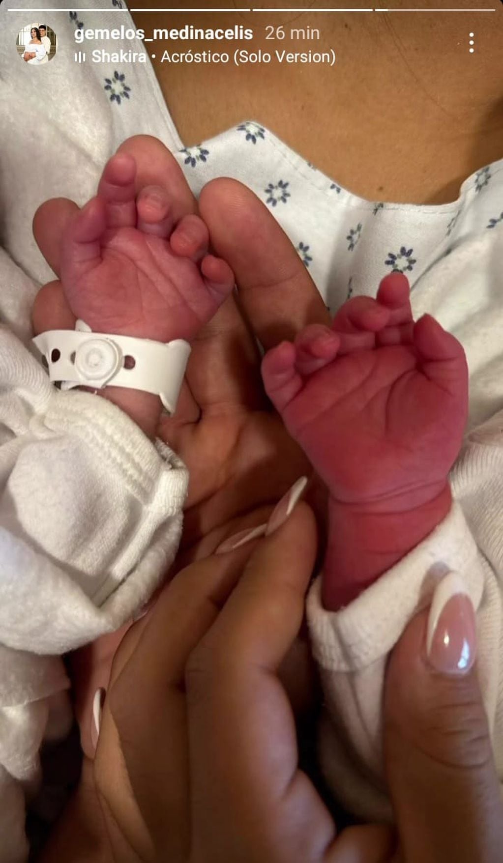 Las gemelas Aime y Laia nacieron con dos minutos de diferencia