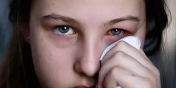 Irritación. Los ojos, víctimas de los virus que circulan estos días. (AP)