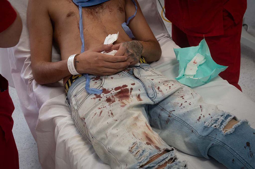 En el Hospital Central de Mendoza, médicos y enfermeros atienden a 
Emiliano Gonzalez Gordillo por una herida de arma de fuego en el rostro durante un intento de robo.  Foto: Ignacio Blanco