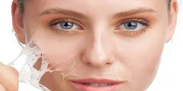 El mal aspecto en la piel suele darse por irregularidades en la ingesta de minerales y nutrientes, ¿cómo notarlo y evitarlo?