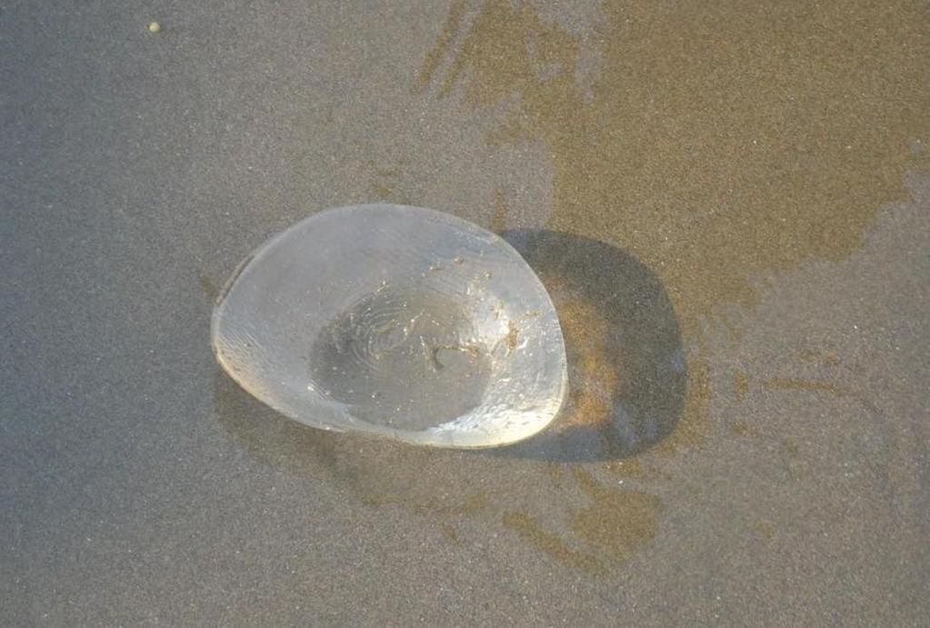 Creyeron que habían encontrado una medusa en la playa y se trataba de un implante mamario