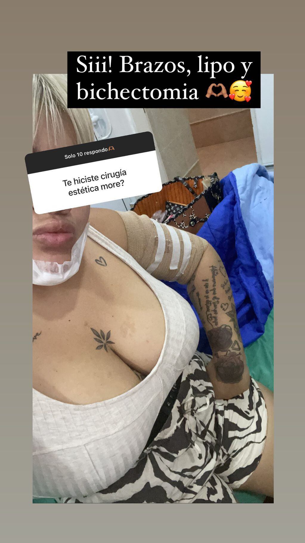 Morena Rial pasó por el quirófano nuevamente y mostró los resultados en Instagram