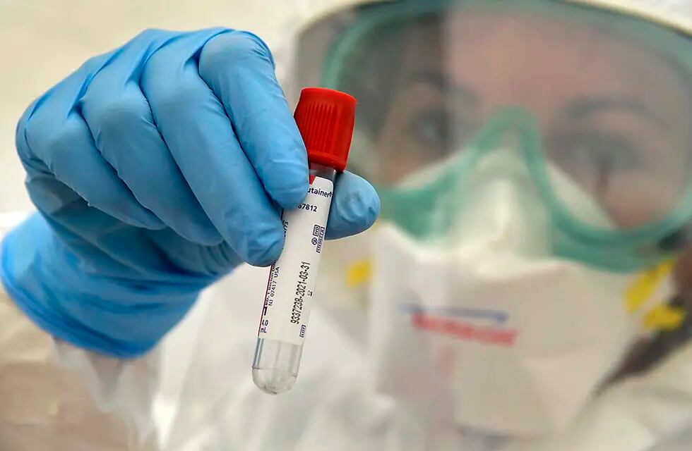 Los testeos siguen siendo fundamentales para detectar y controlar el virus que produce el Covid-19. Foto Orlando Pelichotti / Los Andes

Coronavirus, coronaviru, covi, pandemia, medico, medica, enfermera, positivo, positivos, victima, salud, hospital hisopo