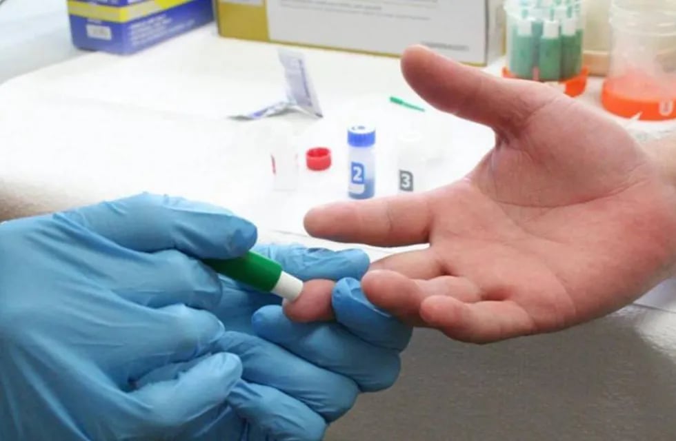 La hepatitis C suele no dar síntomas y muchos desconocen tenerla: harán test gratuitos