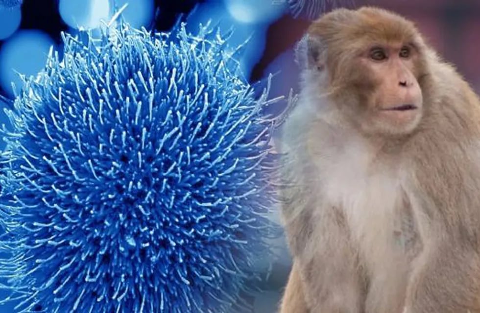 En los seres humanos, los síntomas de la viruela de mono son similares a los síntomas de la viruela, aunque algo más leves. Foto: Web / Los Andes
