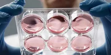 Esta nueva ley ha puesto en debate el tema de la donación de órganos y tejidos, pero ¿qué hay de las células madre, están contempladas?.