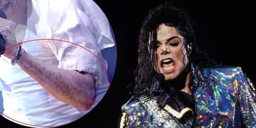 Michael Jackson con vitíligo