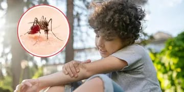 Dengue en niños: cuáles son los síntomas y qué hacer si mi hijo tiene