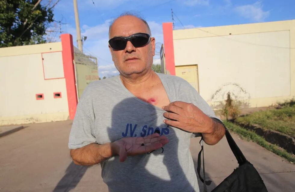 El periodista radial de FM Génesis y FM Libre sufrió el impacto de un balazo de goma en su pecho. / Gentileza.