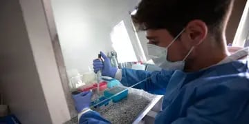 Primer caso de viruela del mono en Córdoba (Ministerio de Salud).