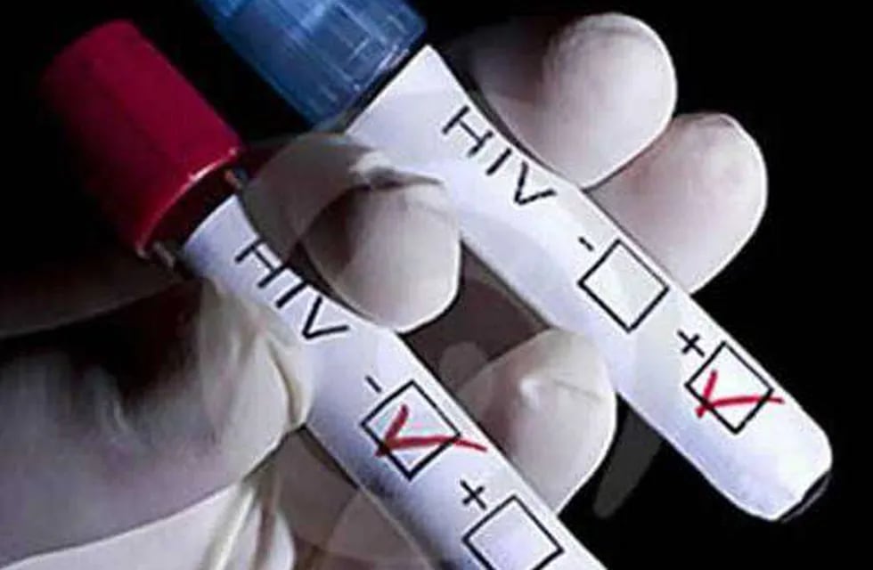 Instan a realizarse test para detectar VIH