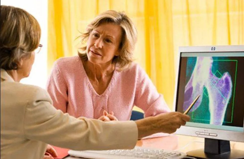 Una de cada cuatro mujeres en menopausia tiene osteoporosis