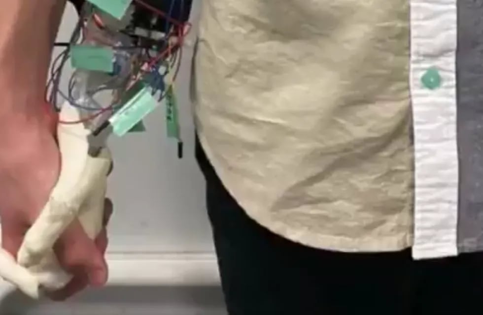 Un grupo de ingenieros inventó una mano robótica que se ajusta y hasta se puede perfumar, para no sentir soledad.