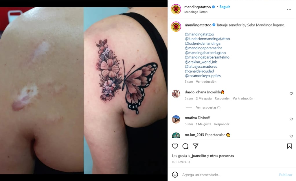 La casa de Tatuajes realiza tatuajes sanadores a quienes tienen cicatrices o han sobrevivido al cáncer de mama